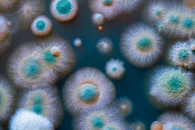 Mahwah NJ - Mold - A Health Concern